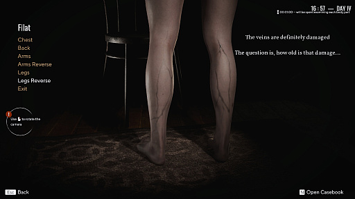 画像ギャラリー No.005のサムネイル画像 / 人気ホラーゲームシリーズ最新作「Pathologic 3」の配信がついにスタート。12日間で謎の伝染病から村人たちを救え