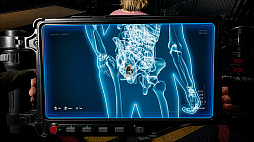 画像ギャラリー No.006のサムネイル画像 / 噛み傷，赤い目，高熱などゾンビ化の兆候を見極めて対処。ゾンビ検問シム「Quarantine Zone: The Last Check」本日発売