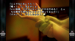 バロックシンドローム